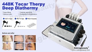 448khz tecar therapy machine  sokingbeauty [upl. by Yhtommit]