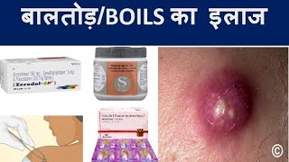 बालतोड़ boils का कारण लक्षण और इलाज medicine for boils pharmacy medicine painkillers [upl. by Seena253]