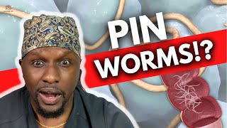 Pinworms Symptoms Treatments and Prevention [upl. by Narut]