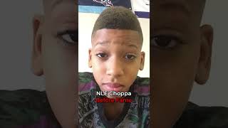 Rappers Before And After Fame 🔥  NLE Choppa shorts nlechoppa [upl. by Lybis900]