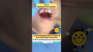 साबुत दांत निकल जाए तो दुबारा वहीं दांत लग सकता है Tooth Avulsion Dr Praveen Bhatia teeth dr [upl. by Grindle]