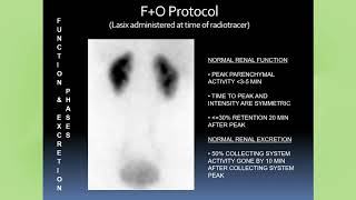 Diuretic Renal Scintigraphy in 2020 Where We Are February 2020 [upl. by Enileda604]