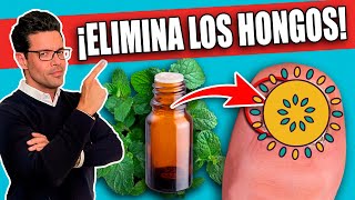 ¡Elimina HONGOS en las UÑAS en 1 DÍA⁉️  REMEDIOS NATURALES para HONGOS en las UÑAS [upl. by Niltiak]