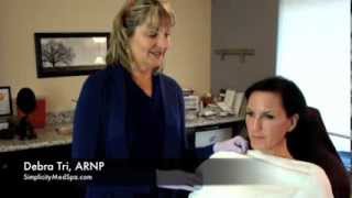 Juvederm Voluma XC Demonstration  Cheek Fillers  Seattle [upl. by Nelra789]