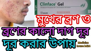 Clinface Gel এর কার্যকারিতা কি মুখের ব্রণ ও ব্রণের কালো দাগ দূর করার উপায় [upl. by Paschasia]