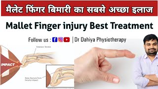 Mallet Finger injury Best Treatment  मैलेट फिंगर का सबसे अच्छा इलाज  Dr Dahiya Physiotherapy [upl. by Selig934]