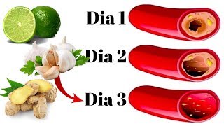 ¡Destapa tus Arterias ADIÓS INFARTOS  Con 1 Solo Vaso de Este Sumo por la Mañana [upl. by Elacim619]