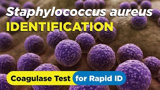 How to identify Staphylococcus aureus using the Coagulase Test  Slide and Tube Method [upl. by Strenta]