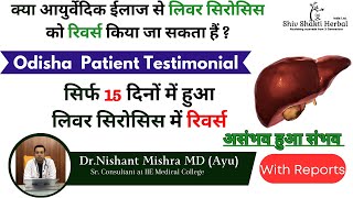 मात्र 15 दिनों में हुआ लिवर सिरोसिस रिवर्स  Ayurveda Treatment of Liver Cirrhosis with Reports [upl. by Sidon412]