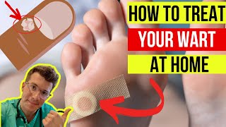 Doctor explains how to treat WARTS at home plus when to seek medical attention [upl. by Stempien713]