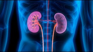 kidney transplantation and hypertensive nephrosclerosis [upl. by Hortensia]