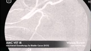 Interventional Radiology IntraArterial Chemotherapy for Bladder Cancer [upl. by Barclay]