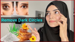 Natural cure for dark circles under your eyes  Dr Amee Daxini [upl. by Kimbell]