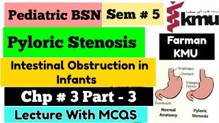 Pyloric Stenosis in URDUHindi  Pediatric Nursing  BSN Sem  5 Unit  3 part3 KMU MCQS Pattern [upl. by Nibur]