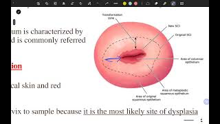 pap smear and colposcopy part 1 [upl. by Enajiram]