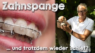 Zahnspange raus und trotzdem wieder schief Warum Zähne wieder schief werden 🦷 Vorsicht bei Retainer [upl. by Berton297]