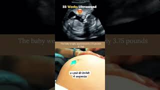 32 weeks pregnancy ultrasound pregnancy [upl. by Kcirddehs207]