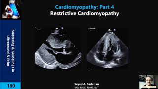 Restrictive Cardiomyopathy [upl. by Ecnaret354]