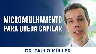 Microagulhamento  Tratamento para Queda de Cabelo – Dr Paulo Müller Dermatologista [upl. by Yenffit]