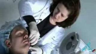 Microdermabrasion  Procedures [upl. by Macintyre]