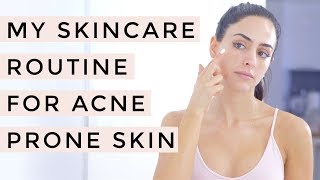 Acne Treatment  Acne Skin Care Routine  Dr Mona Vand [upl. by Celik]