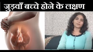 जुड़वाँ बच्चे होने का आसान तरीका  Twins Pregnancy and Symptoms [upl. by Snehpets]