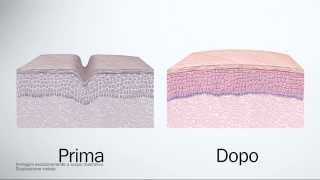 Fillerina Biorevitalizing  Trattamento effetto filler dermocosmetico ed effetto biorivitalizzante [upl. by Hanahsuar]