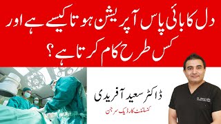 How Does Heart Bypass Work Coronary Artery Bypass Graft Procedure  Dr Saeed Afridi [upl. by Randell292]