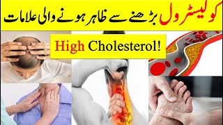 Signs Your Arteries Full Of Cholesterol  High Cholesterol Signs and Symptoms in UrduHindi [upl. by Nedearb417]