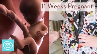 11 Weeks Pregnant What You Need To Know  Channel Mum [upl. by Ian118]