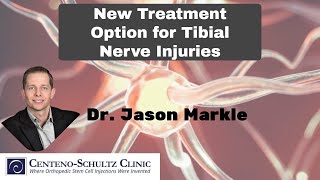 New Treatment Option for Tibial Nerve Injury [upl. by Truitt]