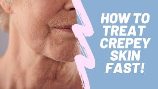 3 Powerful Ways to get rid of Crepey Skin Fast  How to Treat Crepey Skin [upl. by Snider738]