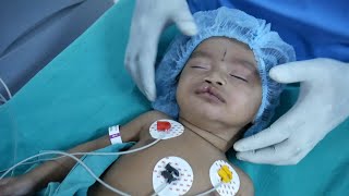 Intubation Procedure for a Pediatric Child by Expert Anesthesia Doctors at Richardsons [upl. by Kirad]