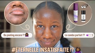 Avoir une belle peau noire sans taches avec la vitamine A  mon bilan 2 mois inattendu [upl. by Eecats]