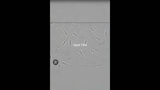 Sperm cell morphology and sperm under microscope [upl. by Juline414]