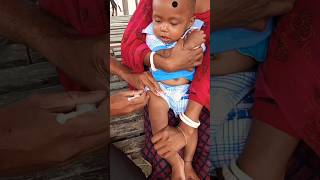 baby injection crying video shorts viral trending [upl. by Howland575]