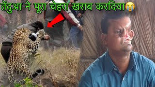 तेंदुए ने ये क्या हाल किया😭Leopard Attack In Indian Village Man  Leopard Attack Video  viralvideo [upl. by Chappell]