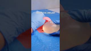 My surgeon learned from 5 minute crafts videos😥 [upl. by Cadmann803]