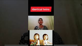 monochorionoc Diamniotic twins pregnancy kya hoti hai identical twins pregnancy dizygotic twins preg [upl. by Bianca]