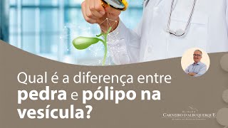 Qual é a diferença entre pedra e pólipo na vesícula  Prof Dr Luiz Carneiro CRM 22761 [upl. by Andrade]