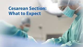 Cesarean Section What to Expect [upl. by Erwin930]