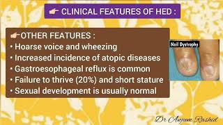 Ectodermal Dysplasia Symptoms Types Causes Diagnosis Treatment amp Life Expectancy [upl. by Noislla918]