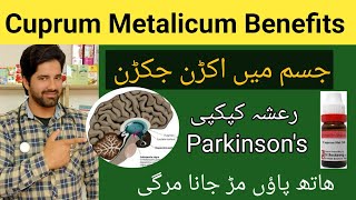 Cuprum Metalicum Benefits Cuprum Met 30 Homeopathic mlMedicine Uses by Dr Sherazi Homeopathic [upl. by Rosenblast373]