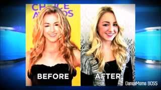 Chloe Lukasiak On The Doctors Disscussing Her Eye Situation [upl. by Ric]