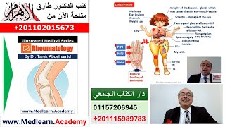 Rheumatoid Arthritis RA cme internalmedicine usmle medicalschool medical محاضراتباطنة [upl. by Dong884]