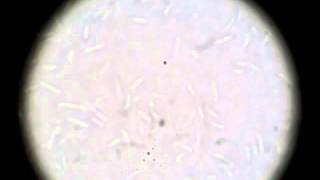 Hanging drop method Motility test 16k Views viral bacteria microbiology science [upl. by Muns]