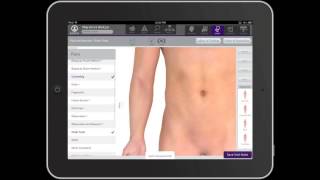 EMA Dermatology iPad EMR Test Drive a Challenging Case [upl. by Orelee]