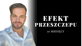 EFEKTY PRZESZCZEPU WŁOSÓW  10 miesięcy [upl. by Clare95]