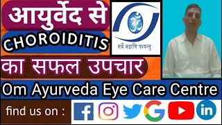 Choroiditis Ayurveda Eye Treatments [upl. by Edmond]