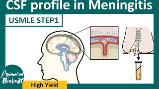 CSF analysis in Meningitis  Easy way to remember CSF analysis in meningitis flow chart [upl. by Carry]